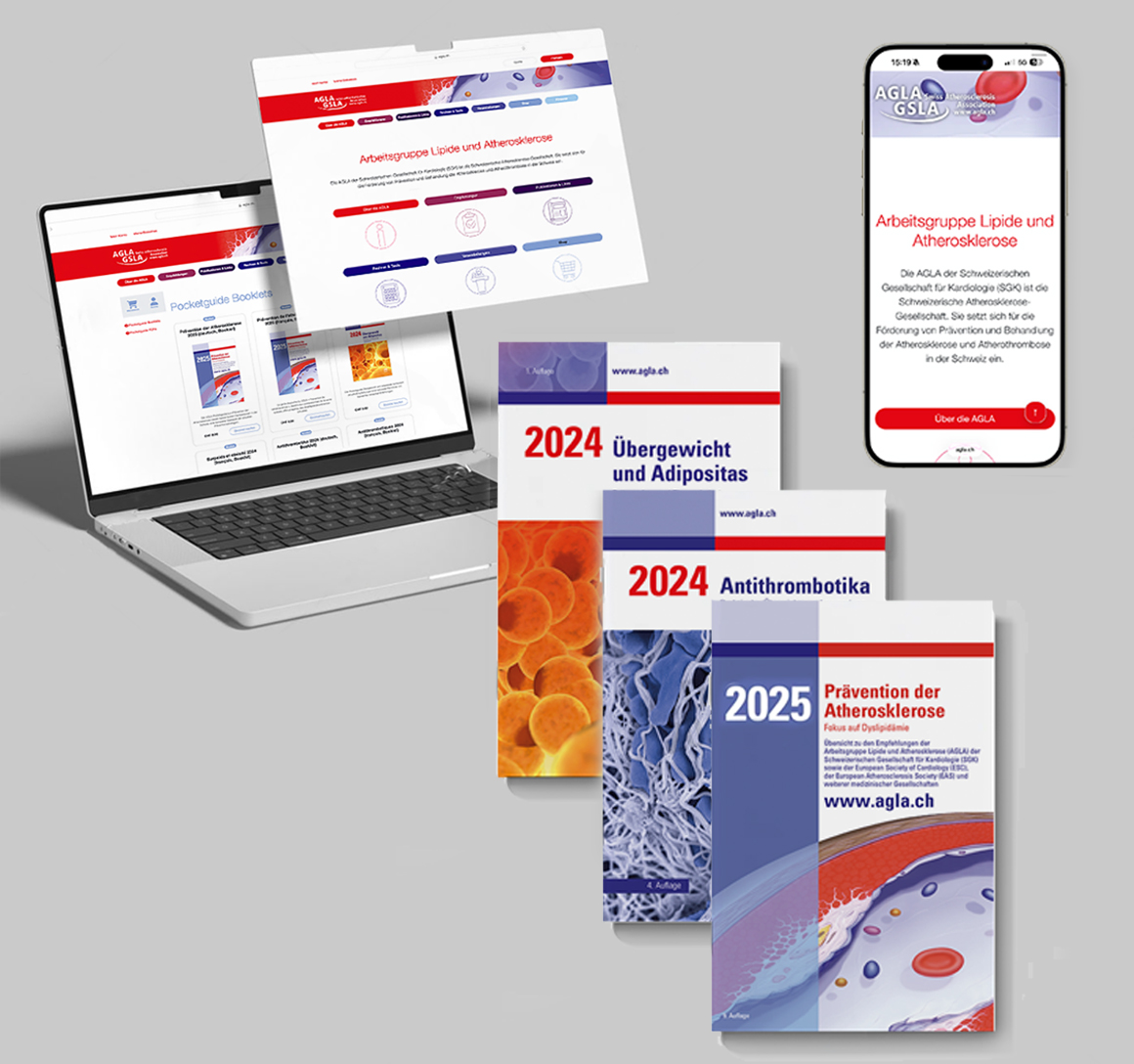 Arbeitsgruppe Lipide und Atherosklerose